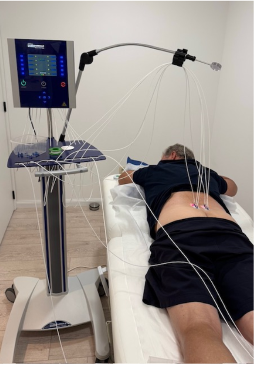 Laseracupunctuur behandeling